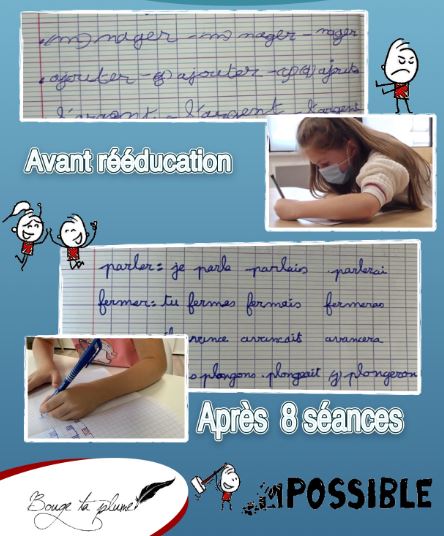 Les progrès de Noémie, 8 ans, après 8 séances de rééducation.